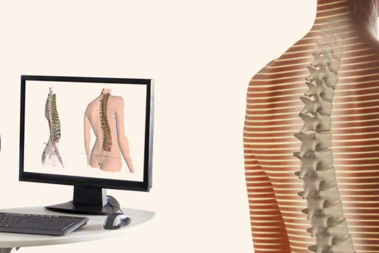 Praxis Dr Seibert Bad Vilbel Wirbelsaeulenvermessung